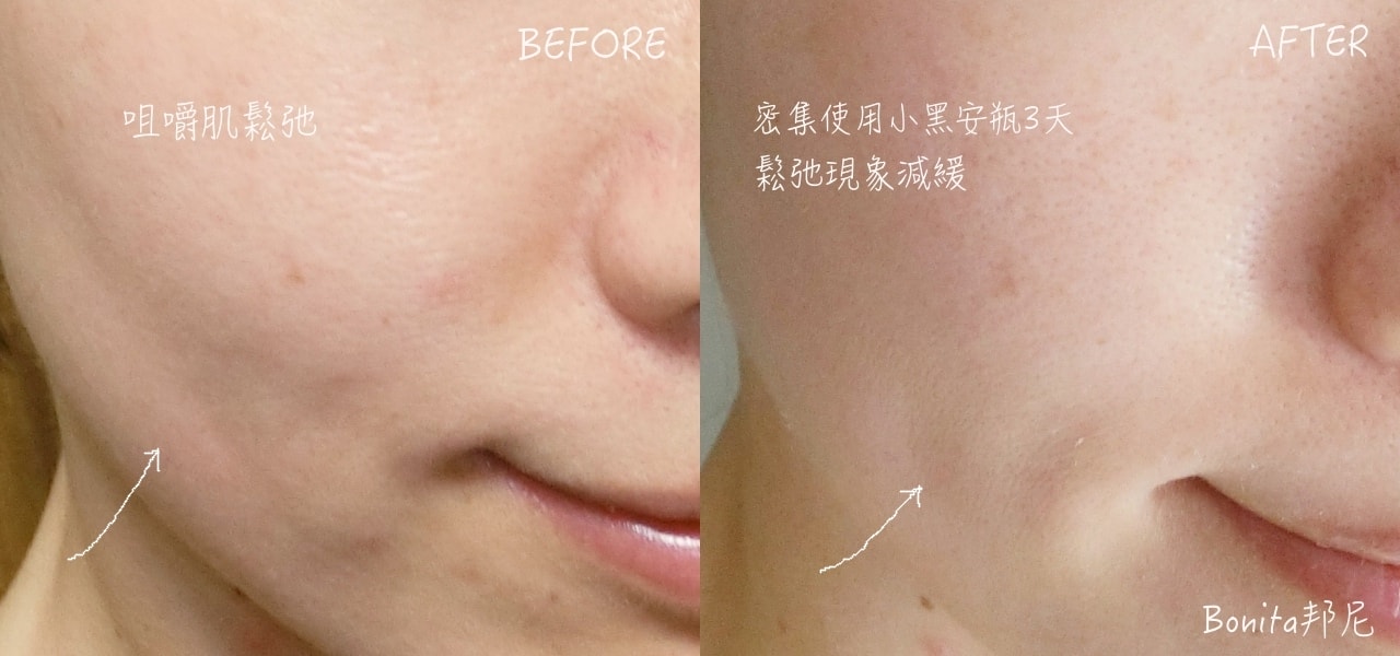 蘭蔻小黑安瓶10.jpg
